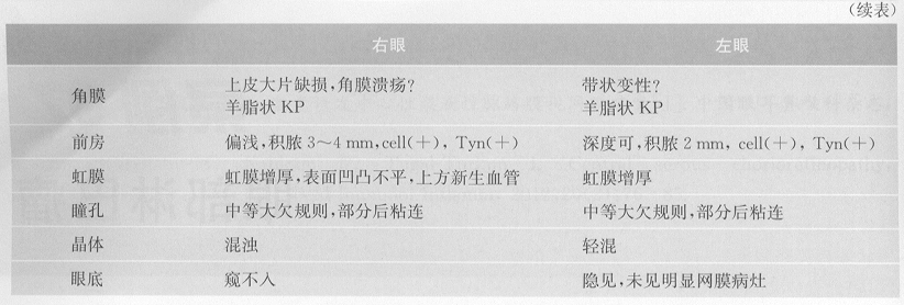 ZY016_194_1.gif